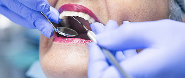 Best Urgent Care for Lost Fillings or Crowns in Bonnetsville, NC
